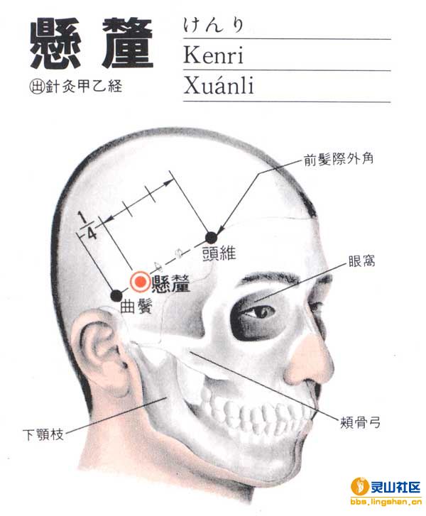 悬厘穴