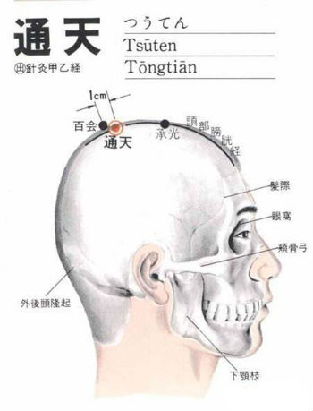 通天穴