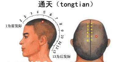 通天穴